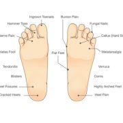 Common_foot_problems
